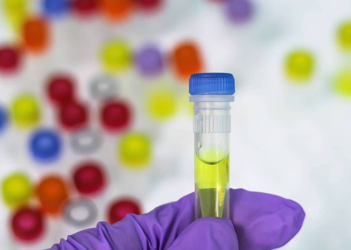 בדיקת PCR – שומרים על הבריאות של כולנו