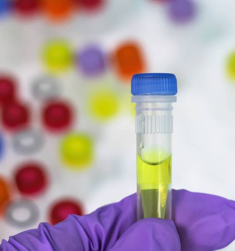 בדיקת PCR – שומרים על הבריאות של כולנו