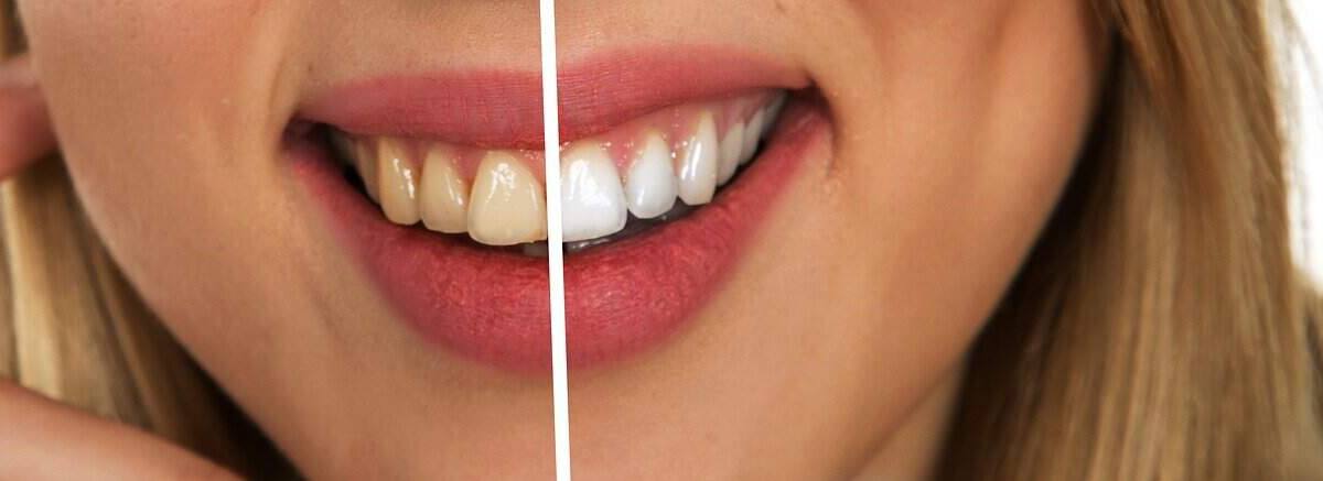 מה הם לימודיו של רופא השיניים?